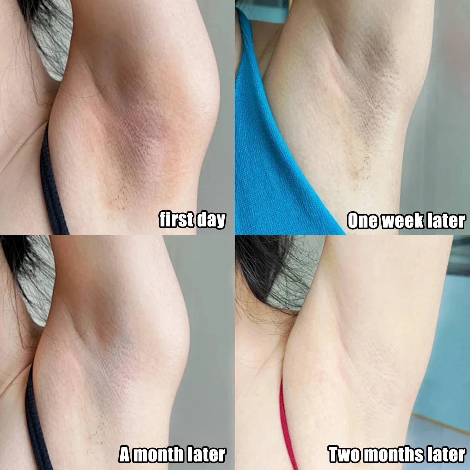 콜라겐 겨드랑이 미백 크림 (어두운 피부용), 겨드랑이 - Skincare Whitening 리뷰 및 가격