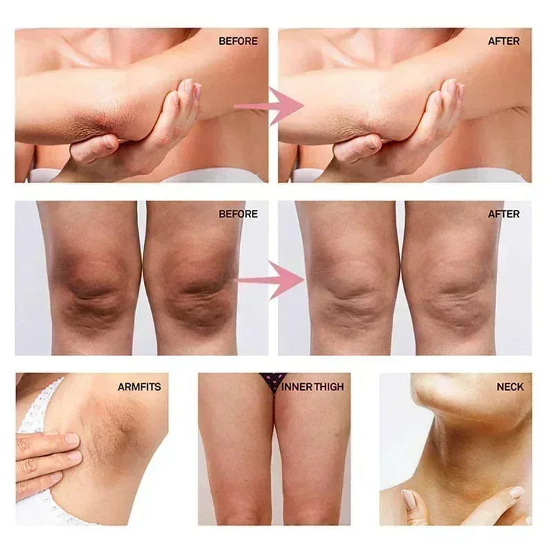 콜라겐 겨드랑이 미백 크림 (어두운 피부용), 겨드랑이 - Skincare Whitening 리뷰 및 가격