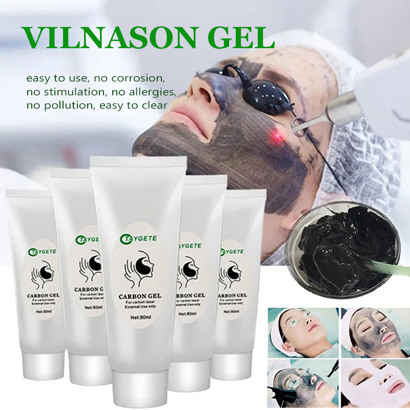 ND YAG 레이저 스킨 필링 카본 크림 화이트닝 페이 - Skincare Whitening 리뷰 및 가격