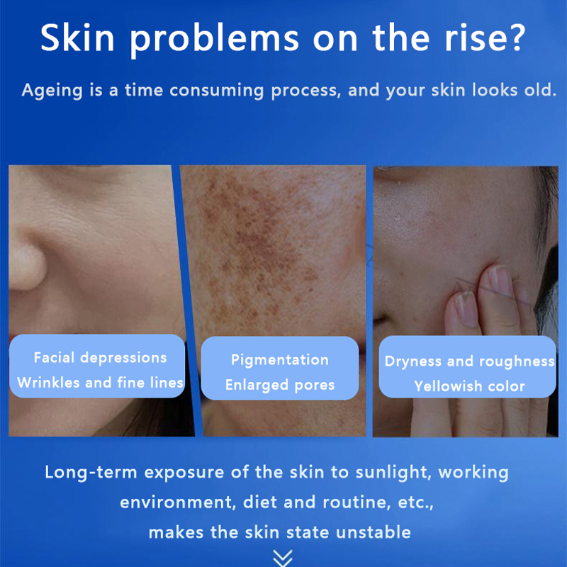 페이스 블루 스펀지 미세조류 스킨 부스터 스킨케어 키트 - Skincare Whitening 리뷰 및 가격