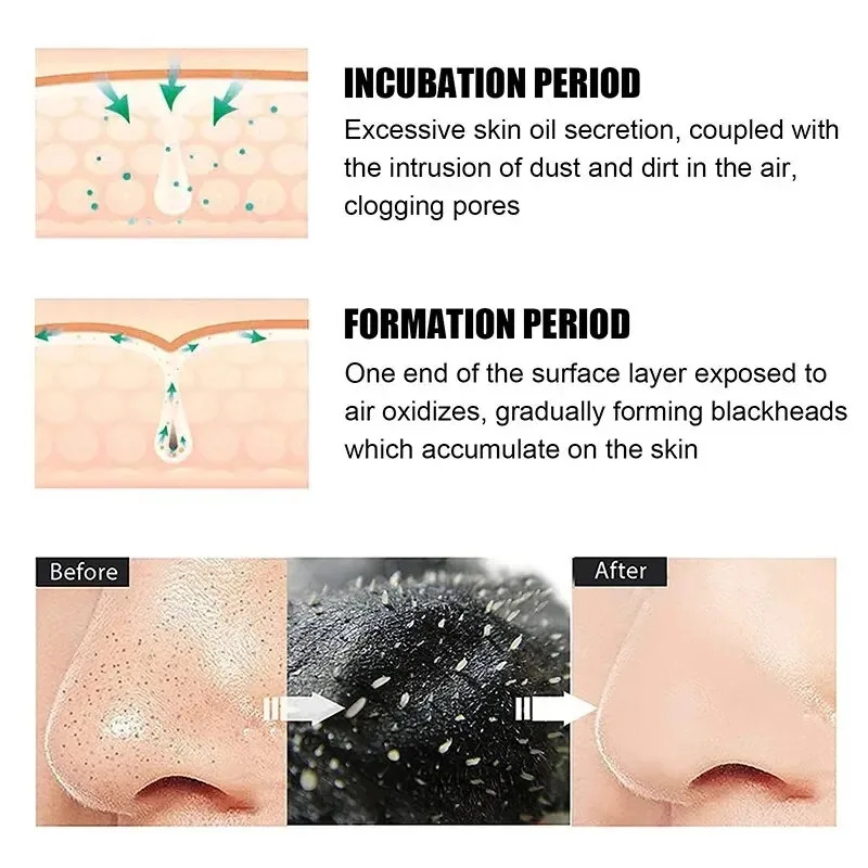 10/150PCS 블랙헤드 제거 마스크 코 스트립 수축 - Skincare Finally Found You 리뷰 및 가격